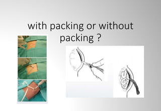 with packing or without
packing ?
 
