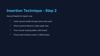Loop Insert Thread Looping Lift Presentation the best thread technique | PPTX