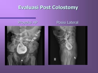 Loopografi Normal Radiologi LOOPOGRAFI.pdf