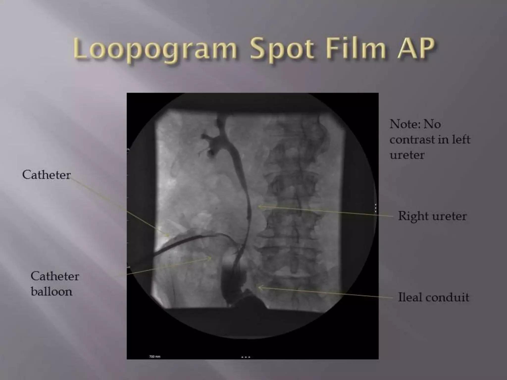 Loopogram ppt