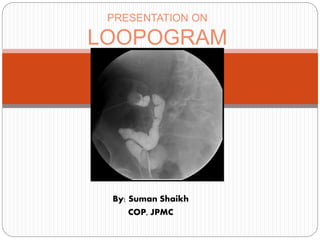 By: Suman Shaikh
COP, JPMC
PRESENTATION ON
LOOPOGRAM
 