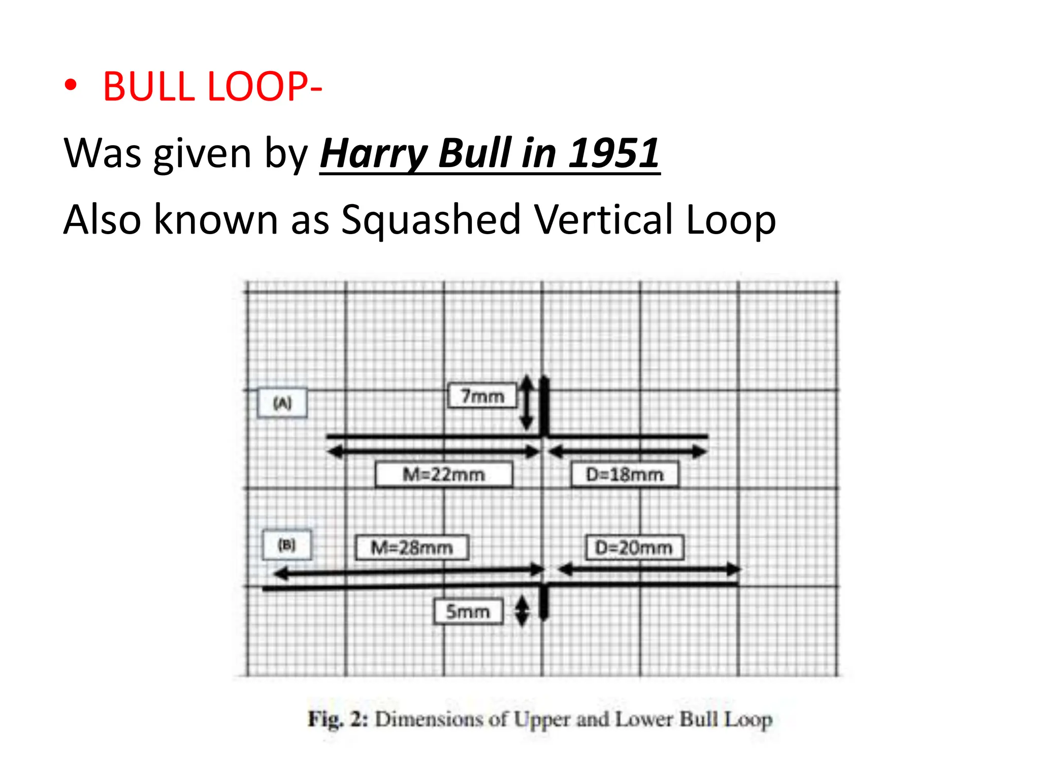 LOOPS in orthodontics t loop bull loop vertical loop mushroom loop stop ...