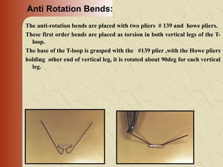 Loops in orthodontics and its uses [Autosaved]..ppt