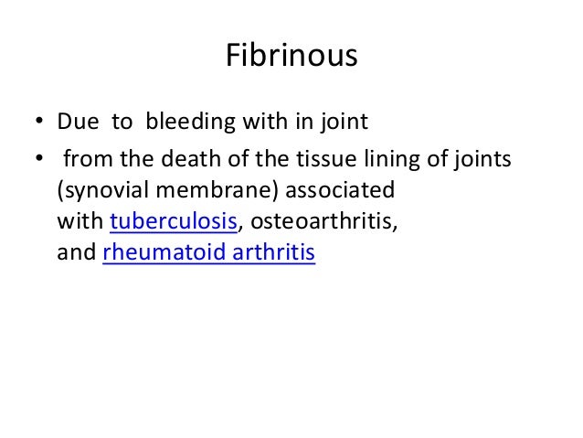 Loose Bodies In Knee