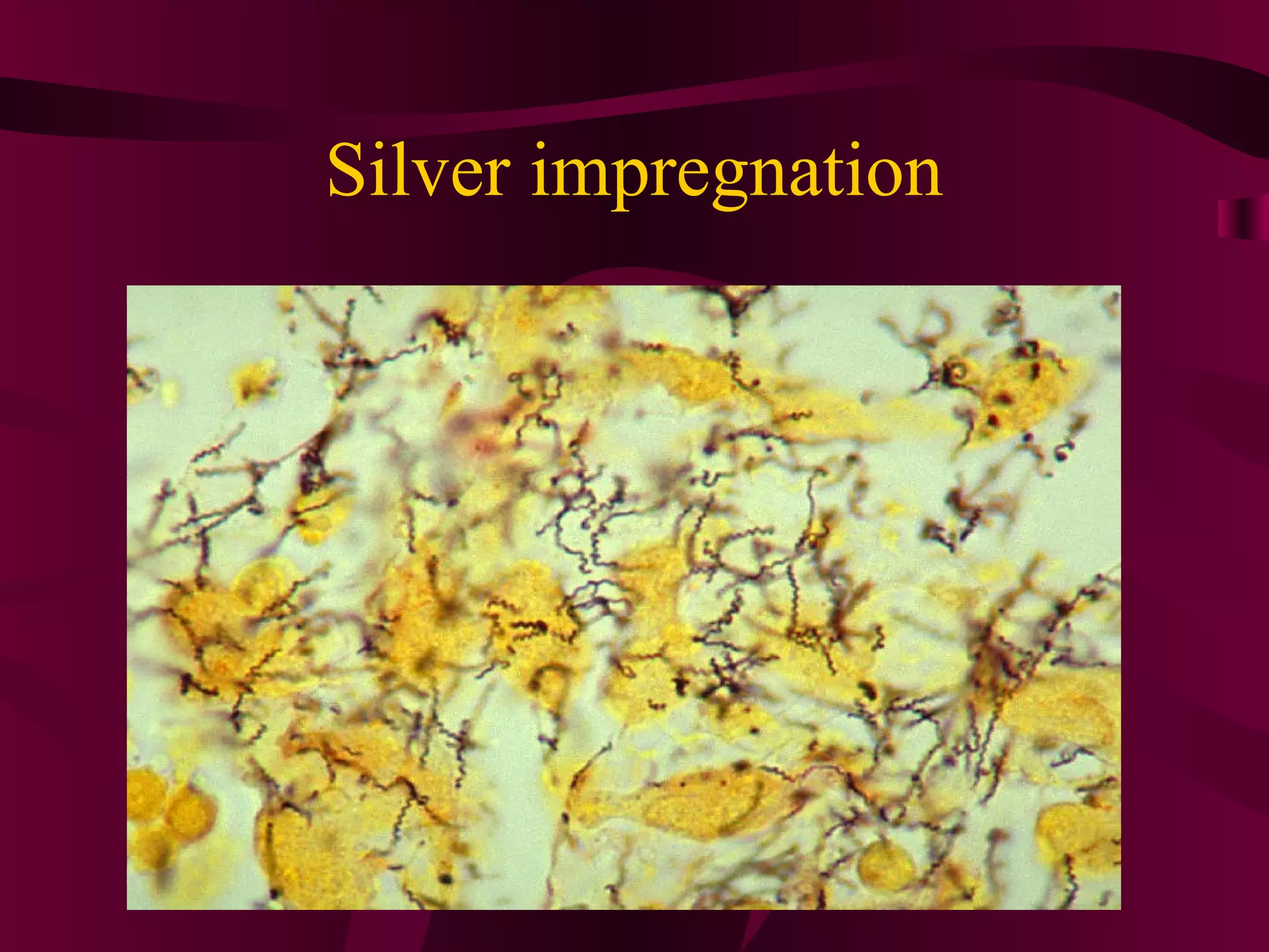 Silver impregnation
 