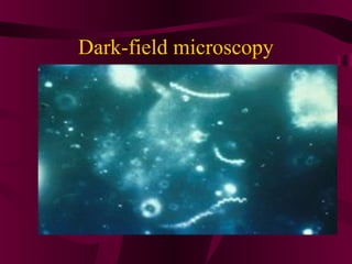 Dark-field microscopy
 