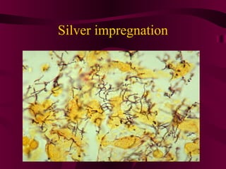 Silver impregnation
 