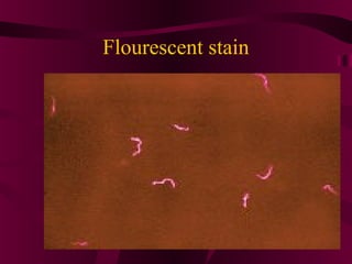 Flourescent stain
 