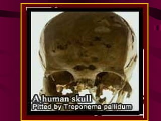 [Micro] syphilis