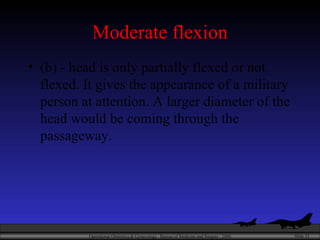 Moderate flexion (b) - head is only partially flexed or not flexed. It gives the appearance of a military person at attention. A larger diameter of the head would be coming through the passageway.  