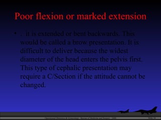 Poor flexion or marked extension .  it is extended or bent backwards. This would be called a brow presentation. It is difficult to deliver because the widest diameter of the head enters the pelvis first. This type of cephalic presentation may require a C/Section if the attitude cannot be changed.  