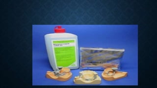 View of Dental casting investment materials | PPTX