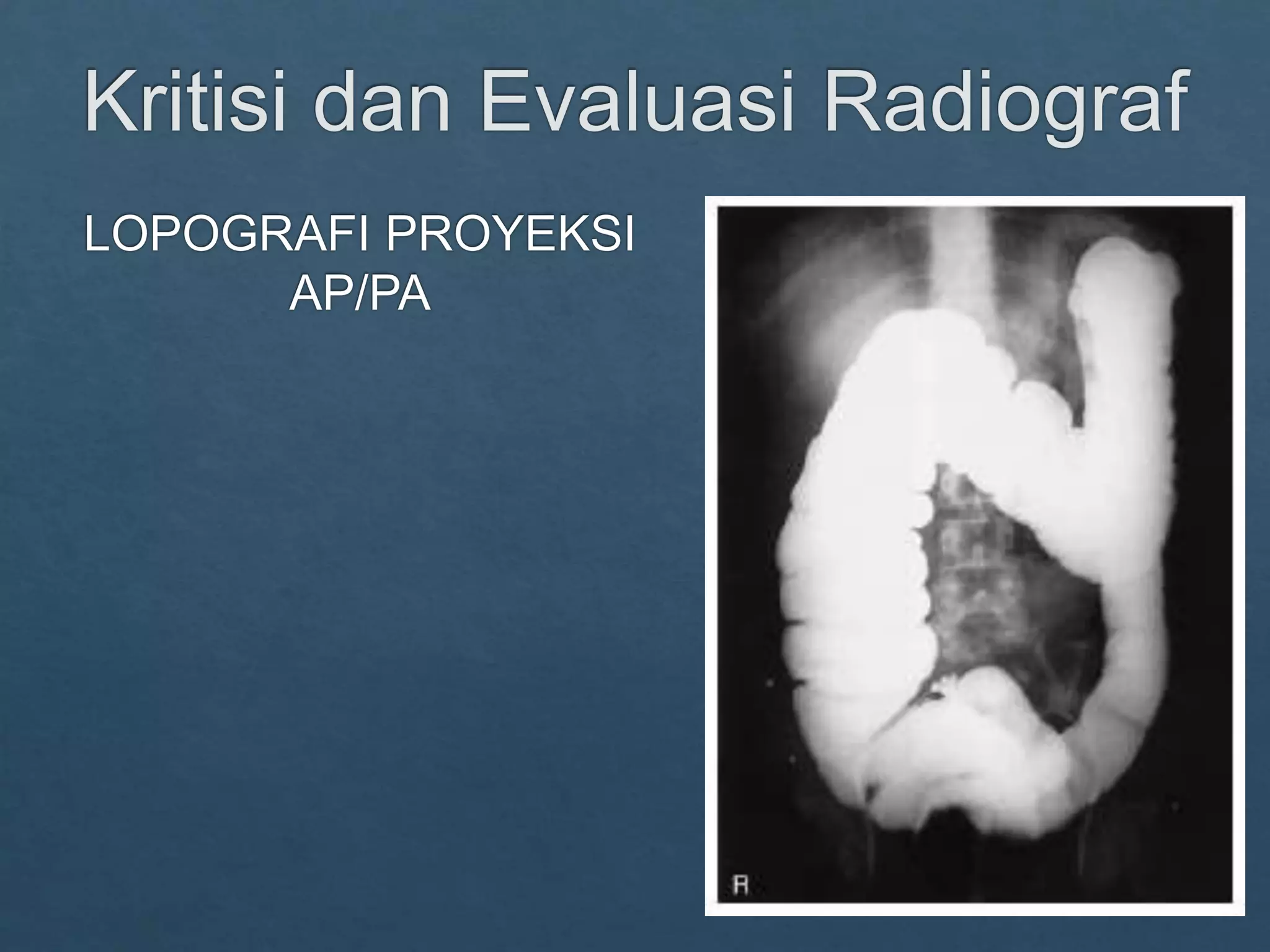 Loopografi Normal Radiologi ppt kritisi dan evaluasi radiograf Lopografi | PPTX