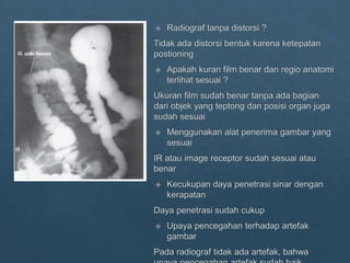 Loopografi Normal Radiologi ppt kritisi dan evaluasi radiograf Lopografi | PPTX