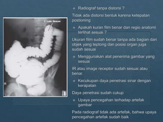 Loopografi Normal Radiologi ppt kritisi dan evaluasi radiograf Lopografi | PPTX