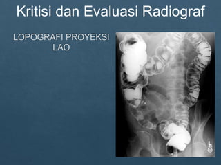 Loopografi Normal Radiologi ppt kritisi dan evaluasi radiograf Lopografi | PPTX