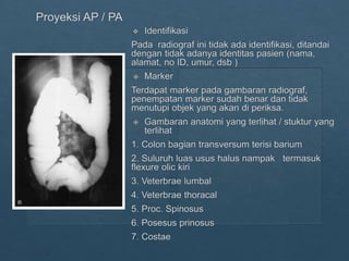 Loopografi Normal Radiologi ppt kritisi dan evaluasi radiograf Lopografi | PPTX