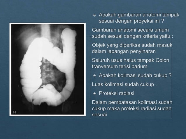 Loopografi Normal Radiologi ppt kritisi dan evaluasi radiograf Lopografi | PPTX
