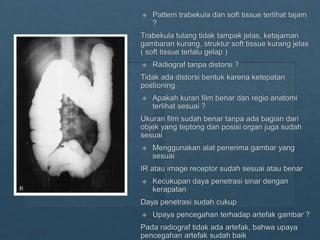 Loopografi Normal Radiologi ppt kritisi dan evaluasi radiograf Lopografi | PPTX