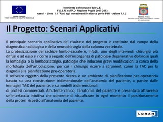 Il Progetto: Scenari Applicativi
UNIONE EUROPEA
FONDO EUROPEO DI SVILUPPO REGIONALE
REGIONE PUGLIA
AREA POLITICHE PER LO SVILUPPO IL LAVORO
E L’INNOVAZIONE
Il principale scenario applicativo del risultato del progetto è costituito dal campo della
diagnostica radiologica e della neurochirurgia della colonna vertebrale.
La protesizzazione del rachide lombo-sacrale è, infatti, uno degli interventi chirurgici più
diffusi e ad esso si ricorre a seguito dell’insorgenza di patologie degenerative dolorose quali
la lombalgia o la lombosciatalgia, patologie che inducono gravi modificazioni a carico della
morfologia dell’articolazione, per cui il chirurgo ricorre a strumenti come la TAC per la
diagnosi e la pianificazione pre-operatoria.
Il software oggetto della presente ricerca è un ambiente di pianificazione pre-operatoria
basato su una ricostruzione tridimensionale dell’anatomia del paziente, a partire dalle
immagini TAC del paziente, e su modelli tridimensionali
di protesi commerciali. All’utente clinico, l’anatomia del paziente è presentata attraverso
un’interfaccia intuitiva che consente di visualizzare in ogni momento il posizionamento
della protesi rispetto all’anatomia del paziente.
Intervento cofinanziato dall’U.E.
F.E.S.R. sul P.O. Regione Puglia 2007-2013
Asse I – Linea 1.1 “Aiuti agli investimenti in ricerca per le PMI - Azione 1.1.2
 