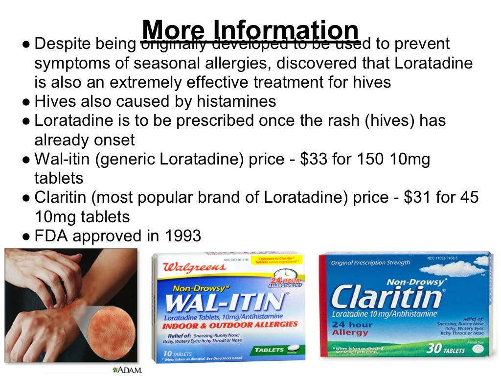 Loratadine