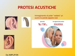 PROTESI ACUSTICHE
Immaginando di poter “vedere” un
suono la parola appare così
Da AMPLIFON
 