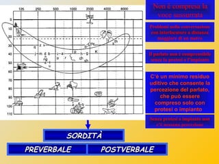 •NORMALE (con soglia inferiore a 20 decibel)
•LIEVE (con soglia tra 20 e 40 decibel)
•MEDIA (con soglia tra 40 e 60 decibe...
