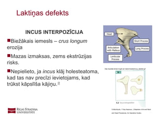 18
INCUS INTERPOZĪCIJA
Biežākais iemesls – crus longum
erozija
Mazas izmaksas, zems ekstrūzijas
risks.
Nepielieto, ja incus klāj holesteatoma,
kad tas nav precīzi ievietojams, kad
trūkst kāpslīša kājiņu.[2]
Laktiņas defekts
http://audilab.bmed.mcgill.ca/~daren/media/incus_labeled.gif
G.Mochloulis, F.Kay Seymour, J.Stephens «Ent and Neck
and Head Procedures. An Operative Guide»
 