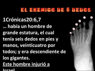 1Crónicas20:6,7
… había un hombre de
grande estatura, el cual
tenía seis dedos en pies y
manos, veinticuatro por
todos; y era descendiente de
los gigantes.
Este hombre injurió a
 