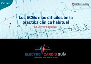 Los ECGs más difíciles en la
práctica clínica habitual
Dr. Javier Higueras
Los ECGs que todos debemos conocer
 