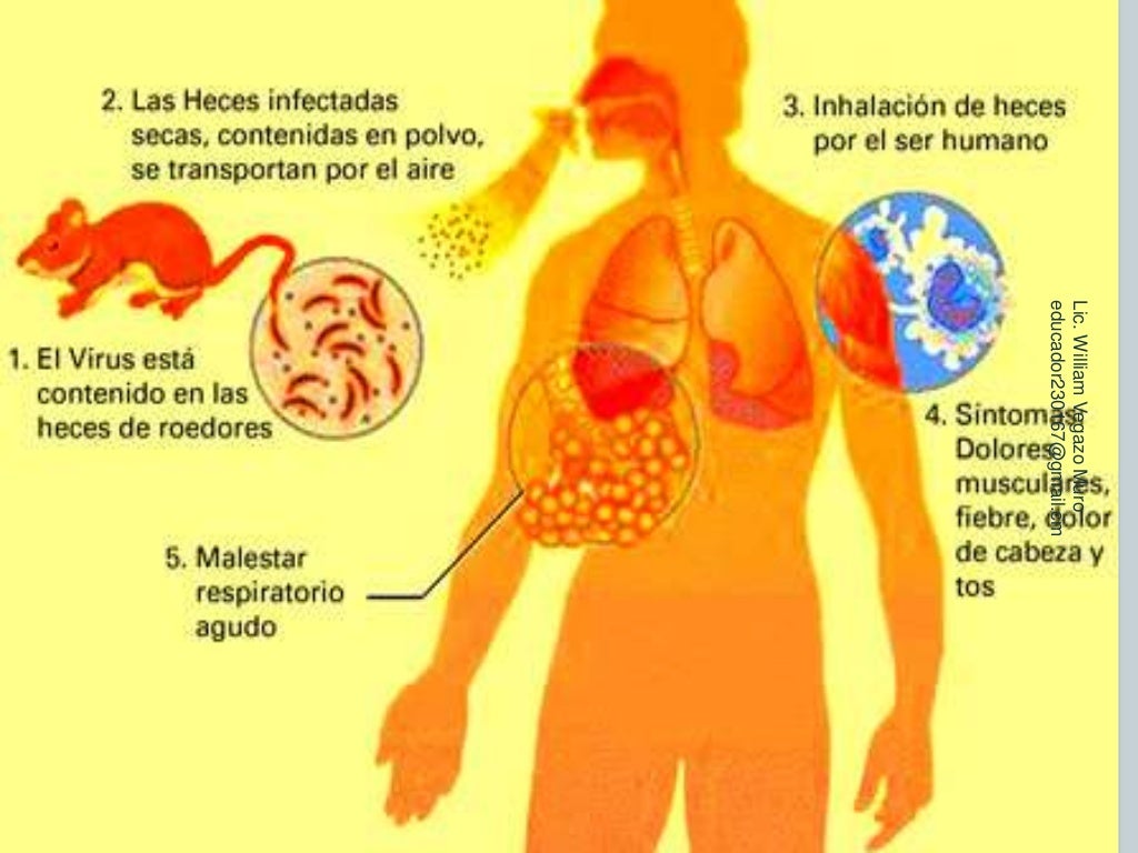 Los 10 virus más peligrosos del mundo