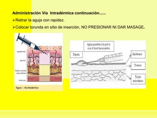 Administración Vía Intradérmica continuación......
Retirar la aguja con rapidez.
Colocar torunda en sitio de inserción, NO PRESIONAR NI DAR MASAGE.
 