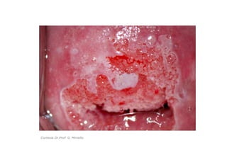 Cortesía Dr.Prof. G. Miniello
 