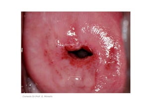 Cortesía Dr.Prof. G. Miniello
 