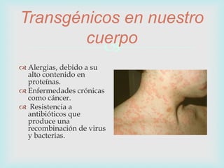 
Transgénicos en nuestro
cuerpo
 Alergias, debido a su
alto contenido en
proteínas.
 Enfermedades crónicas
como cáncer.
 Resistencia a
antibióticos que
produce una
recombinación de virus
y bacterias.
 