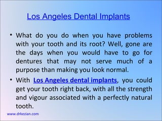 [object Object],[object Object],Los Angeles Dental Implants   www.drkezian.com 