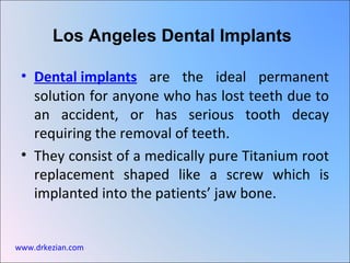 [object Object],[object Object],Los Angeles Dental Implants www.drkezian.com 