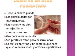  Tiene

la cabeza grande.
 Las extremidades son
muy pequeñas.
 Las manos y los pies
enrojecidas y
con pocos surcos.
 Muy poca masa muscular.
 Sus genitales están poco desarrollados.
 La piel es muy fina y brillante lo que hace
que se vean las venas y arterias superficiales.

 