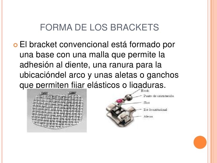 Lo s brackets