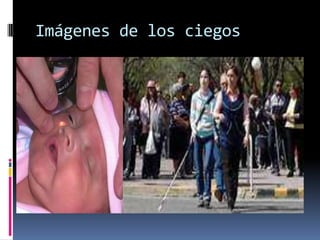 Imágenes de los ciegos