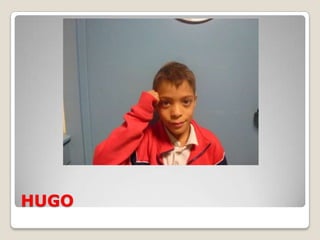 HUGO
 