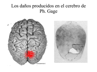 Los daños producidos en el cerebro de Ph. Gage 