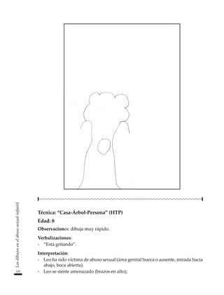 182
Los
dibujos
en
el
abuso
sexual
infantil
Técnica: “Casa-Árbol-Persona” (HTP)
Edad: 8
Observaciones: dibuja muy rápido.
Verbalizaciones:
-	 “Está gritando”.
Interpretación:
-	 Leo ha sido víctima de abuso sexual (área genital hueca o ausente, mirada hacia
abajo, boca abierta).
-	 Leo se siente amenazado (brazos en alto);
 