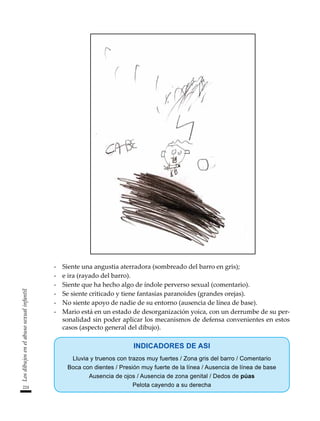 224
Los
dibujos
en
el
abuso
sexual
infantil
-	 Siente una angustia aterradora (sombreado del barro en gris);
-	 e ira (rayado del barro).
-	 Siente que ha hecho algo de índole perverso sexual (comentario).
-	 Se siente criticado y tiene fantasías paranoides (grandes orejas).
-	 No siente apoyo de nadie de su entorno (ausencia de línea de base).
-	 Mario está en un estado de desorganización yoica, con un derrumbe de su per-
sonalidad sin poder aplicar los mecanismos de defensa convenientes en estos
casos (aspecto general del dibujo).
INDICADORES DE ASI
Lluvia y truenos con trazos muy fuertes / Zona gris del barro / Comentario
Boca con dientes / Presión muy fuerte de la línea / Ausencia de línea de base
Ausencia de ojos / Ausencia de zona genital / Dedos de púas
Pelota cayendo a su derecha
 