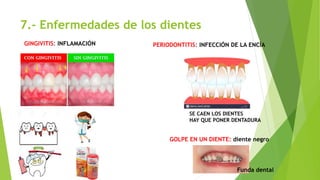 7.- Enfermedades de los dientes
GINGIVITIS: INFLAMACIÓN PERIODONTITIS: INFECCIÓN DE LA ENCÍA
SE CAEN LOS DIENTES
HAY QUE PONER DENTADURA
GOLPE EN UN DIENTE: diente negro
Funda dental
 