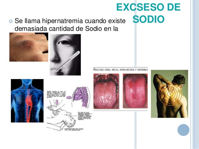 El tratamiento a la osteocondrosis sheynogo del departamento en la fase inicial