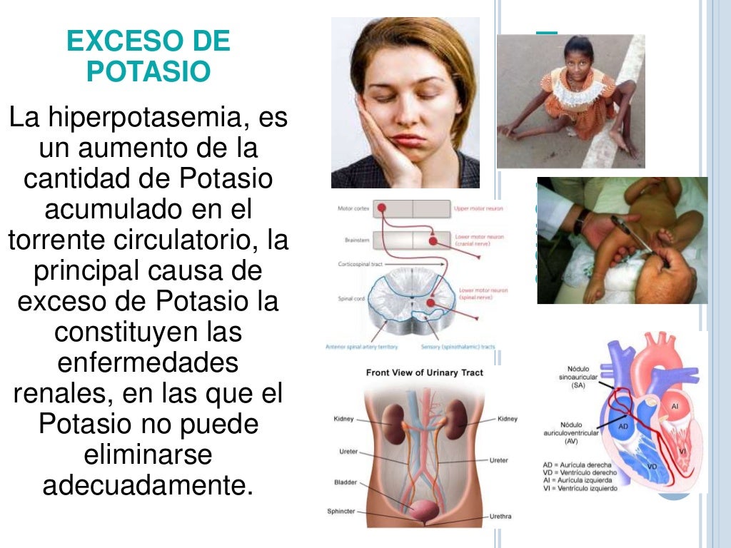 Los electrolitos en el organismo, importancia y alteraciones (1)