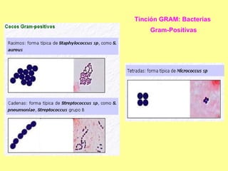 Tinción GRAM: Bacterias  Gram-Positivas 