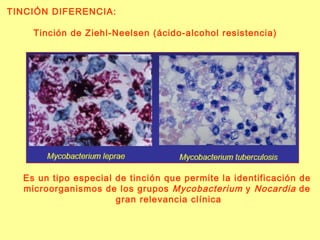 TINCIÓN DIFERENCIA: Tinción de Ziehl-Neelsen (ácido-alcohol resistencia)  Es un tipo especial de tinción que permite la identificación de  microorganismos de los grupos  Mycobacterium  y  Nocardia  de  gran relevancia clínica 