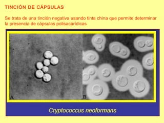 TINCIÓN DE CÁPSULAS Se trata de una tinción negativa usando tinta china que permite determinar la presencia de cápsulas polisacarídicas 